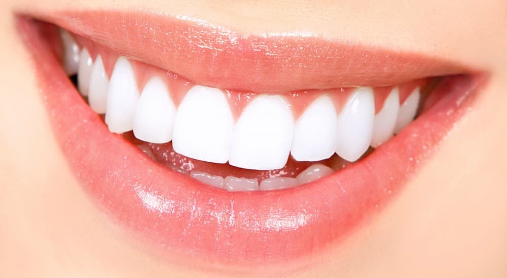 Zâmbet armonios obținut prin tratamente de estetică dentară